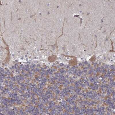 Immunohistochemistry-Paraffin: Dishevelled-3 Antibody [NBP2-38846]