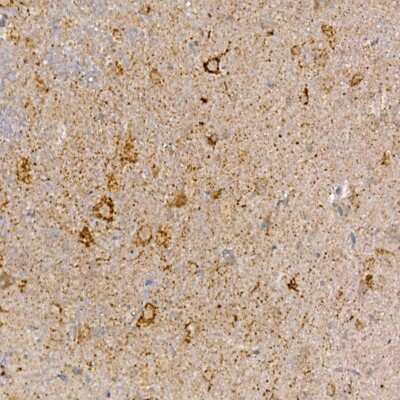 Immunohistochemistry-Paraffin: Dishevelled-3 Antibody - Azide and BSA Free [NBP3-03068]