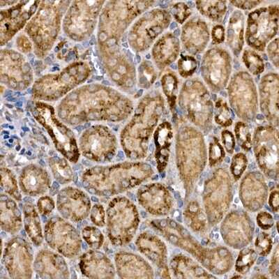 Immunohistochemistry-Paraffin: Dishevelled-3 Antibody - Azide and BSA Free [NBP3-03068]