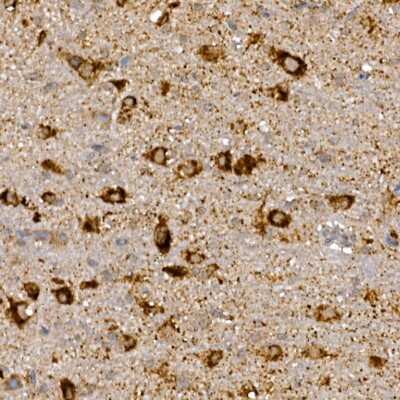 Immunohistochemistry-Paraffin: Dishevelled-3 Antibody - Azide and BSA Free [NBP3-03068]