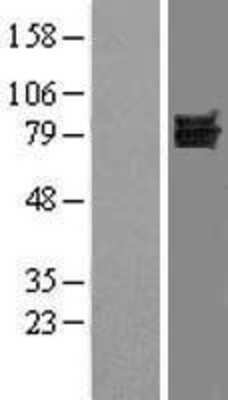 Western Blot: Dishevelled-1 Overexpression Lysate [NBL1-10061]