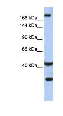 Western Blot: DISP1 Antibody [NBP1-59442]