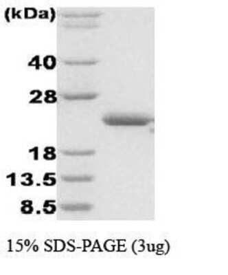 SDS-PAGE: Recombinant E. coli Disulfide oxidoreductase Protein [NBC1-18365]