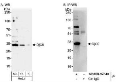 Western Blot: DjC9 Antibody [NB100-97848]