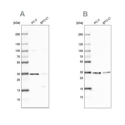 Western Blot: DjC9 Antibody [NBP1-87903]