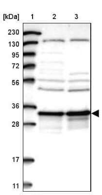 Western Blot: DjC9 Antibody [NBP2-33997]