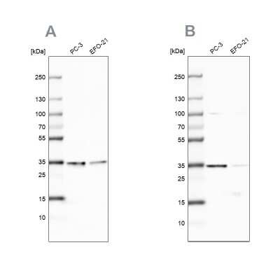 Western Blot: DjC9 Antibody [NBP2-33997]