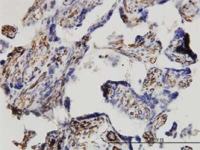 Immunohistochemistry-Paraffin: Dkk-1 Antibody (2A5) [H00022943-M11]
