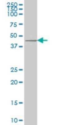 Western Blot: Dkk-1 Antibody (2A5) [H00022943-M11]