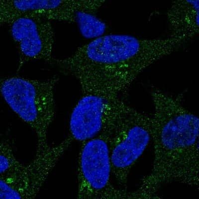 Immunocytochemistry/ Immunofluorescence: Dkk-2 Antibody [NBP2-68703]