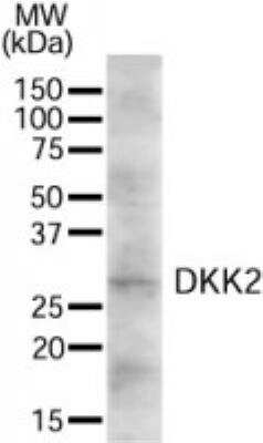 Western Blot: Dkk-2 Antibody [NB300-810]