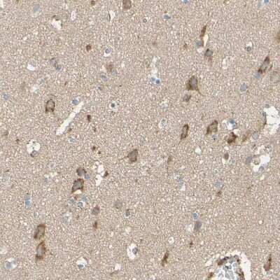 Immunohistochemistry-Paraffin: Dkk-3 Antibody [NBP1-80843]