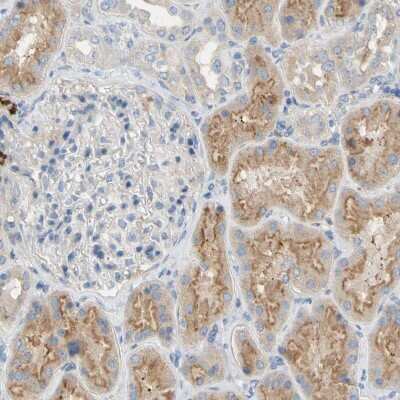 Immunohistochemistry-Paraffin: Dkk-3 Antibody [NBP1-80843]