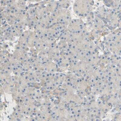Immunohistochemistry-Paraffin: Dkk-3 Antibody [NBP1-80843]