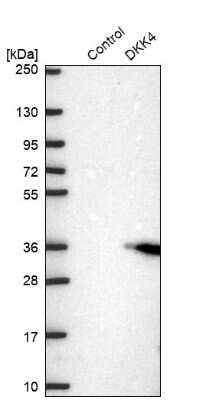 Western Blot: Dkk-4 Antibody [NBP2-47484]