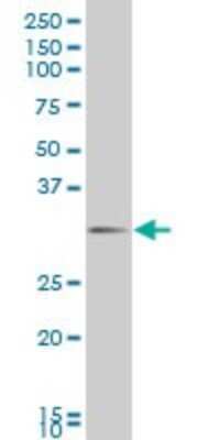 Western Blot: Dlx1 Antibody (1B2) [H00001745-M12]