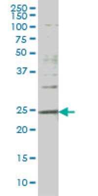 Western Blot: Dlx1 Antibody (2H3) [H00001745-M01]