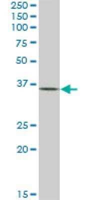 Western Blot: Dlx1 Antibody (2H3) [H00001745-M01]