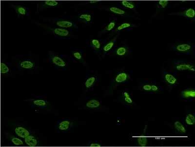 Immunocytochemistry/ Immunofluorescence: Dlx1 Antibody (3F9) [H00001745-M03]