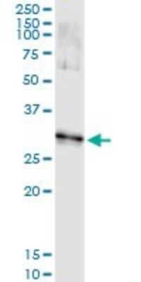 Immunoprecipitation: Dlx1 Antibody (3F9) [H00001745-M03]