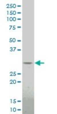 Western Blot: Dlx1 Antibody (4B7) [H00001745-M15]