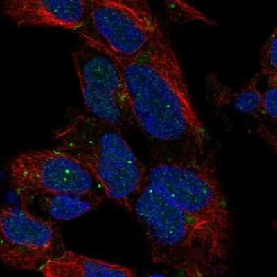 Immunocytochemistry/ Immunofluorescence: Dlx1 Antibody [NBP2-58633]