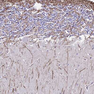 Immunohistochemistry-Paraffin: Dlx1 Antibody [NBP1-91837]