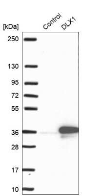 Western Blot: Dlx1 Antibody [NBP1-91837]