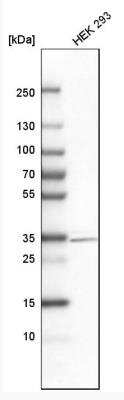 Western Blot: Dlx1 Antibody [NBP1-91837]