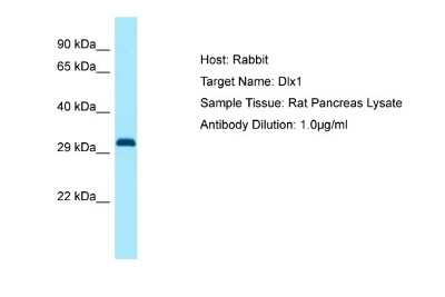 Western Blot: Dlx1 Antibody [NBP1-98334]