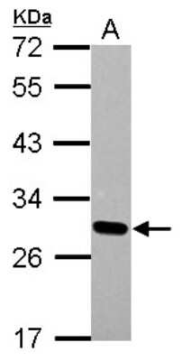 Western Blot: Dlx1 Antibody [NBP2-16178]