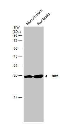 Western Blot: Dlx1 Antibody [NBP2-16178]