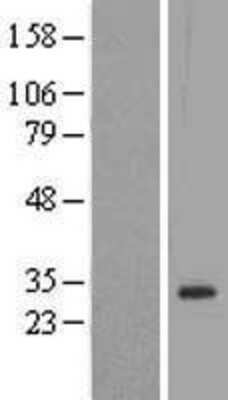 Western Blot: Dlx1 Overexpression Lysate [NBL1-09916]