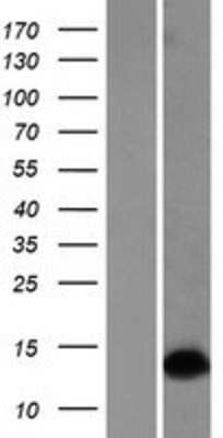 Western Blot: Dlx1 Overexpression Lysate [NBP2-09198]