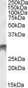 Western Blot: DLX5 Antibody [NBP1-28911]