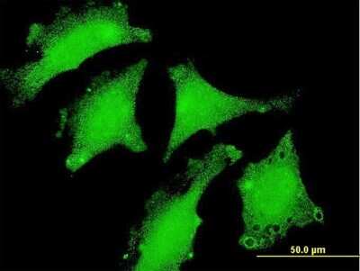 Immunocytochemistry/ Immunofluorescence: Dnd1 Antibody (1F7) [H00373863-M08]