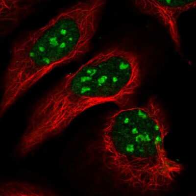 Immunocytochemistry/ Immunofluorescence: Dnmt2 Antibody [NBP2-48670]