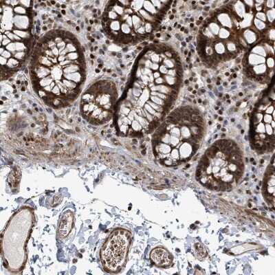 Immunohistochemistry: Dnmt2 Antibody [NBP2-47483]