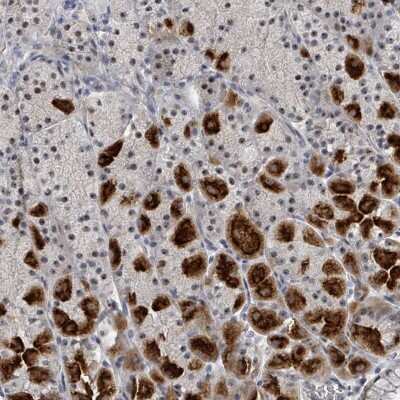 Immunohistochemistry-Paraffin: Dnmt2 Antibody [NBP2-48670]