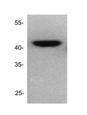 Western Blot: Dnmt2 Antibody [NB200-616]