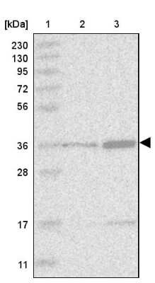 Western Blot: Dnmt2 Antibody [NBP2-47483]