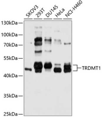 Western Blot: Dnmt2 AntibodyAzide and BSA Free [NBP2-92029]