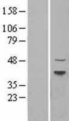 Western Blot: Dnmt2 Overexpression Lysate [NBL1-17263]