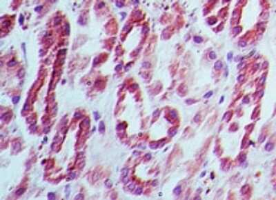 Immunohistochemistry-Paraffin: Dnmt3L Antibody [NBP2-27099]