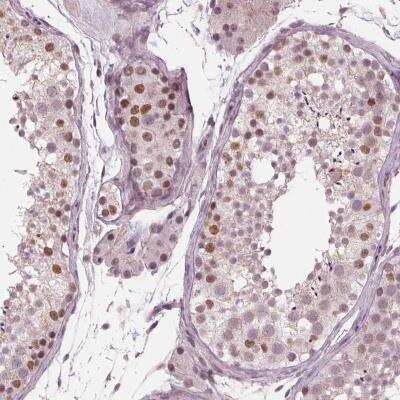 Immunohistochemistry-Paraffin: Dnmt3L Antibody [NBP2-39076]
