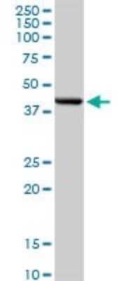 Western Blot: Dnmt3L Antibody [H00029947-D01P]