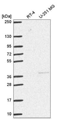 Western Blot: Dnmt3L Antibody [NBP2-58155]