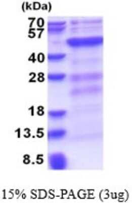 SDS-PAGE: Recombinant Human Dnmt3L His Protein [NBP2-51647]