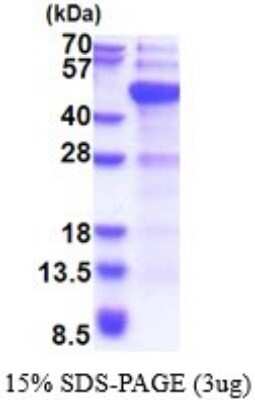 SDS-PAGE: Recombinant Human Dnmt3L His Protein [NBP2-51708]