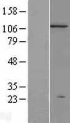 Western Blot: DNMT3A Overexpression Lysate [NBL1-09970]